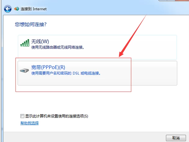 设置宽带 设置宽带